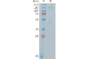 Mouse IGF-1R Protein, His Tag on SDS-PAGE under reducing condition.