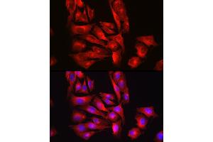 Immunofluorescence analysis of U2OS cells using [KO Validated] Glutathione Synthetase (GSS) Rabbit pAb (ABIN7267451) at dilution of 1:100 (40x lens).