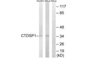 Western blot analysis of extracts from HUVEC cells and HeLa cells, using CTDSP1 antibody. (CTDSP1 anticorps  (N-Term))