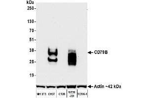 Western Blotting (WB) image for anti-CD79b Molecule, Immunoglobulin-Associated beta (CD79B) (AA 200-250) antibody (ABIN7454006) (Recombinant CD79b anticorps  (AA 200-250))