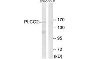 Western blot analysis of extracts from COLO205 cells, using PLCG2 (Ab-753) Antibody. (Phospholipase C gamma 2 anticorps  (AA 721-770))