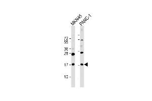 All lanes : Anti-FB Antibody (C-Term) at 1:2000 dilution Lane 1: MKN45 whole cell lysate Lane 2: NC-1 whole cell lysate Lysates/proteins at 20 μg per lane. (FAM159B anticorps  (AA 121-154))