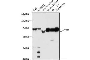 Western blot analysis of extracts of various cell lines using TFEB Polyclonal Antibody at dilution of 1:1000. (TFEB anticorps)