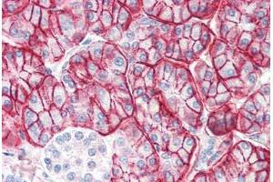 Human Pancreas (formalin-fixed, paraffin-embedded) stained with ENPP1 antibody ABIN337063 at 2. (ENPP1 anticorps  (AA 915-925))