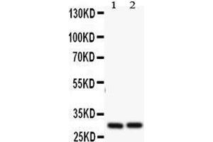 Anti- Bcl2A1 antibody, Western blotting All lanes: Anti Bcl2A1 at 0. (BCL2A1 anticorps  (N-Term))