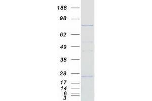 Validation with Western Blot