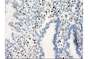 Image no. 1 for anti-Signal Transducer and Activator of Transcription 4 (STAT4) antibody (ABIN1501180)