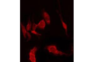 ABIN6274654 staining HepG2 by IF/ICC.