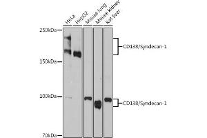 Western blot analysis of extracts of various cell lines, using Syndecan 1 Rabbit mAb (ABIN1683195, ABIN3018651, ABIN3018652 and ABIN7101639) at 1:1000 dilution.