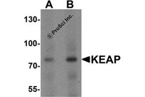 Western Blotting (WB) image for anti-Kelch-Like ECH-Associated Protein 1 (KEAP1) (C-Term) antibody (ABIN1077378) (KEAP1 anticorps  (C-Term))