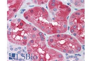 ABIN334402 (3. (FTL anticorps  (C-Term))