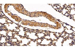 Detection of CLC in Mouse Lung Tissue using Polyclonal Antibody to Charcot Leyden Crystal Protein (CLC)