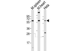 All lanes : Anti-Rad9a Antibody (C-term) at 1:2000 dilution Lane 1: mouse spleen lysates Lane 2: mouse heart lysates Lane 3: Hela whole cell lysates Lysates/proteins at 20 μg per lane.