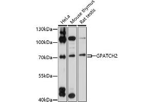 Western blot analysis of extracts of various cell lines, using GP antibody (ABIN7267287) at 1:1000 dilution. (GPATCH2 anticorps  (AA 1-250))