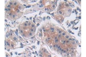 Detection of LIF in Human Stomach Tissue using Polyclonal Antibody to Leukemia Inhibitory Factor (LIF)