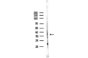 anti-Progestin and AdipoQ Receptor Family Member V (PAQR5) (C-Term) antibody