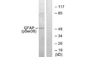 Western blot analysis of extracts from HeLa cells, using GFAP (Phospho-Ser38) antibody. (GFAP anticorps  (pSer38))