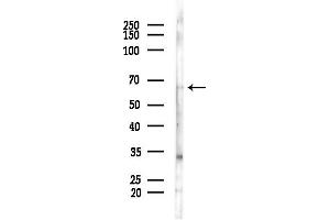 Western blot analysis of lysates from COLO205 cells(heat-shock,45 min treatment), using ARHGAP15 Antibody at 1/1000 dilution.