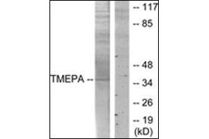 Western blot analysis of extracts from HT-29 cells, using TMEPA Antibody. (PMEPA1 anticorps)