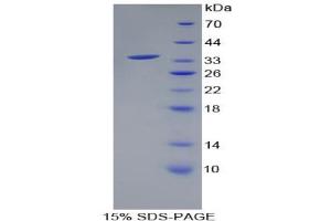 SDS-PAGE analysis of Human HSD17B1 Protein.