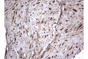 Image no. 1 for anti-Tumor Necrosis Factor Receptor Superfamily, Member 8 (TNFRSF8) (AA 19-379) antibody (ABIN1491084)