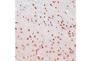 Immunofluorescence analysis of NIH/3T3 cells using CREB1 Rabbit pAb (ABIN7266053) at dilution of 1:50 (40x lens).