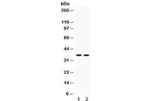 Western blot testing of human 1) HeLa and 2) K562 cell lysate with CD58 antibody. (CD58 anticorps)