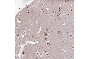 Immunohistochemical staining of human cerebral cortex with THOC7 polyclonal antibody  shows moderate nuclear positivity in neuronal cells at 1:200-1:500 dilution. (THOC7 anticorps)