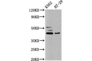 Western Blot Positive WB detected in: K562 whole cell lysate, HT29 whole cell lysate All lanes: B3GNT6 antibody at 10 μg/mL Secondary Goat polyclonal to rabbit IgG at 1/50000 dilution Predicted band size: 43, 30 kDa Observed band size: 43 kDa (B3GNT6 anticorps  (AA 251-345))