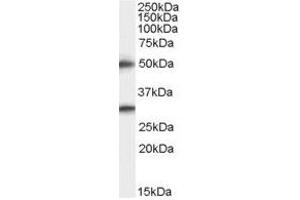 Image no. 1 for anti-Transmembrane Protease, serine 5 (TMPRSS5) (C-Term) antibody (ABIN374177) (TMPRSS5 anticorps  (C-Term))