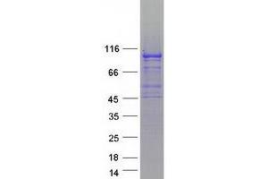 Validation with Western Blot (SLFN5 Protein (Myc-DYKDDDDK Tag))