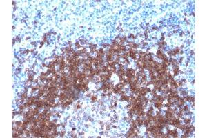 Formalin-fixed, paraffin-embedded human Tonsil stained with CD79a Rabbit Recombinant Monoclonal Antibody (IGA/1790R). (Recombinant CD79a anticorps  (AA 202-216))