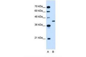 Image no. 1 for anti-Glutamic-Oxaloacetic Transaminase 2, Mitochondrial (Aspartate Aminotransferase 2) (GOT2) (AA 40-89) antibody (ABIN320795)