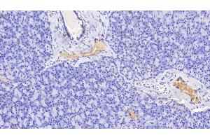 Detection of HB in Human Pancreas Tissue using Polyclonal Antibody to Hemoglobin (HB) (Hemoglobin anticorps)