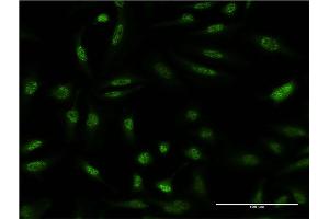 Immunofluorescence of monoclonal antibody to DUSP1 on HeLa cell. (DUSP1 anticorps  (AA 305-367))