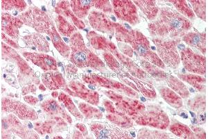Rabbit Anti-AGPAT2 antibody Catalog Number: ARP44636 Formalin Fixed Paraffin Embedded Tissue: Human Adult Heart  Observed Staining: Cytoplasm in hepatocytes Primary Antibody Concentration: 1:600 Secondary Antibody: Donkey anti-Rabbit-Cy3 Secondary Antibody Concentration: 1:200 Magnification: 20X Exposure Time: 0.