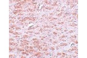 Immunohistochemistry (IHC) image for anti-Caudal Type Homeobox 2 (CDX2) (C-Term) antibody (ABIN1030331) (CDX2 anticorps  (C-Term))