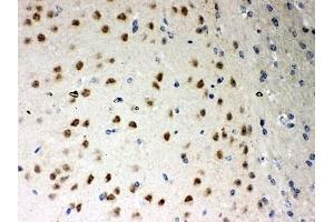 IHC-P: PKC iota antibody testing of mouse brain tissue (PKC iota anticorps  (AA 21-214))
