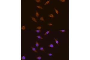 Immunofluorescence analysis of L929 cells using TSG101 antibody  at dilution of 1:100. (TSG101 anticorps  (C-Term))