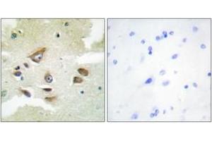 Immunohistochemistry analysis of paraffin-embedded human brain, using CLUS Antibody. (Clusterin anticorps  (AA 400-449))