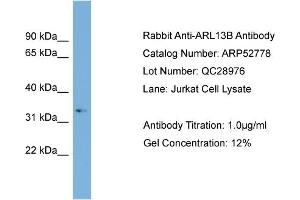 WB Suggested Anti-ARL13B  Antibody Titration: 0.