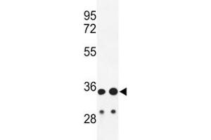 Western blot analysis of IGH antibody and HL-60, A2058 lysate. (IgH anticorps  (AA 290-320))