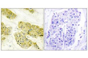 Immunohistochemistry (IHC) image for anti-Collagen, Type V, alpha 3 (COL5A3) (N-Term) antibody (ABIN1850292) (COL5A3 anticorps  (N-Term))