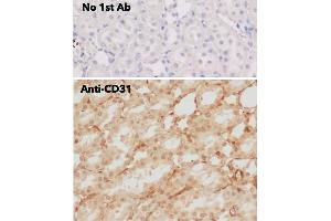 Immunohistochemistry (IHC) image for anti-Platelet/endothelial Cell Adhesion Molecule (PECAM1) (C-Term) antibody (ABIN6254202)