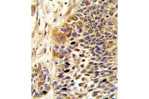 Immunohistochemistry (IHC) image for anti-Wingless-Type MMTV Integration Site Family, Member 4 (WNT4) antibody (ABIN2906061)