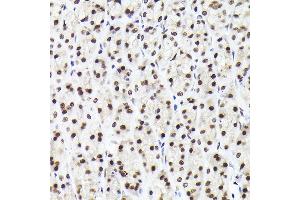 Immunohistochemistry of paraffin-embedded rat stomach using Rad21 Rabbit pAb (ABIN7269822) at dilution of 1:200 (40x lens). (RAD21 anticorps)