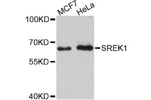 Western blot analysis of extracts of various cell lines, using SREK1 antibody. (SFRS12 anticorps)