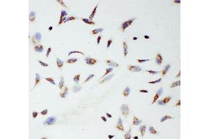 Anti-mtTFA antibody, ICC ICC: HELA Cell