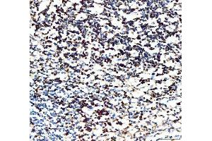 IHC analysis of CD5 using anti-CD5 antibody (ABIN5693203). (CD5 anticorps  (AA 25-495))