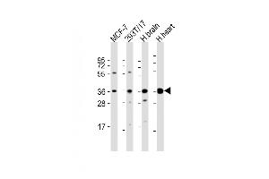 All lanes : Anti-BRCC3 Antibody (N-Term) at 1:2000 dilution Lane 1: MCF-7 whole cell lysate Lane 2: 293T/17 whole cell lysate Lane 3: human brain lysate Lane 4: human heart lysate Lysates/proteins at 20 μg per lane. (BRCC3 anticorps  (AA 18-50))